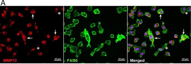 Rat IgG (H+L) Highly Cross-Adsorbed Secondary Antibody in Immunocytochemistry (ICC/IF)