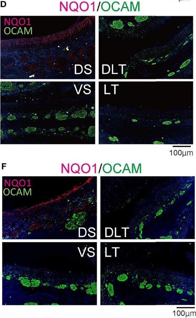 Rabbit IgG (H+L) Highly Cross-Adsorbed Secondary Antibody in Immunohistochemistry (IHC)