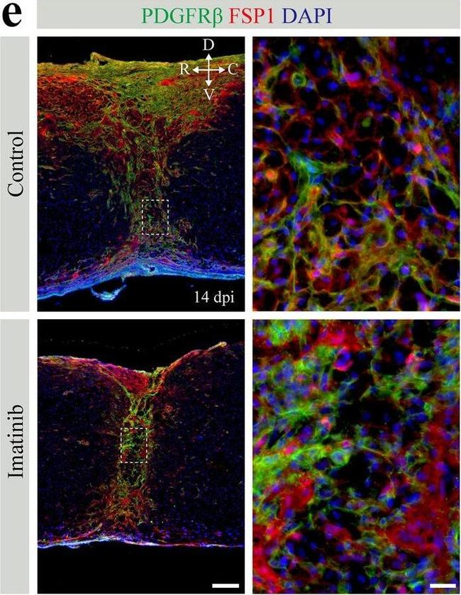 Rabbit IgG (H+L) Highly Cross-Adsorbed Secondary Antibody in Immunohistochemistry (IHC)