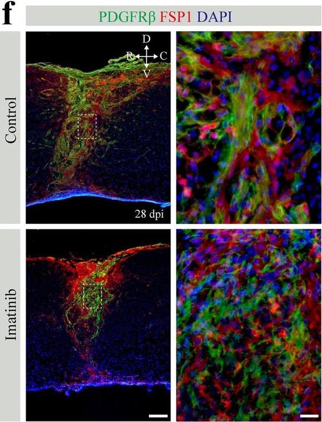 Rabbit IgG (H+L) Highly Cross-Adsorbed Secondary Antibody in Immunohistochemistry (IHC)