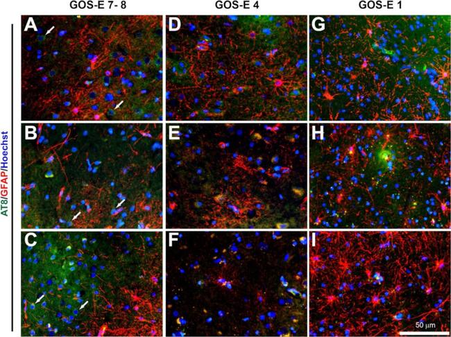 Rabbit IgG (H+L) Highly Cross-Adsorbed Secondary Antibody in Immunohistochemistry (Frozen) (IHC (F))