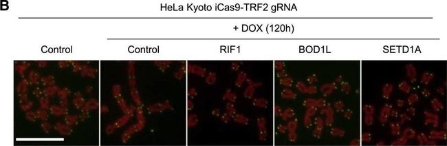 Rabbit IgG (H+L) Highly Cross-Adsorbed Secondary Antibody in Immunocytochemistry (ICC/IF)