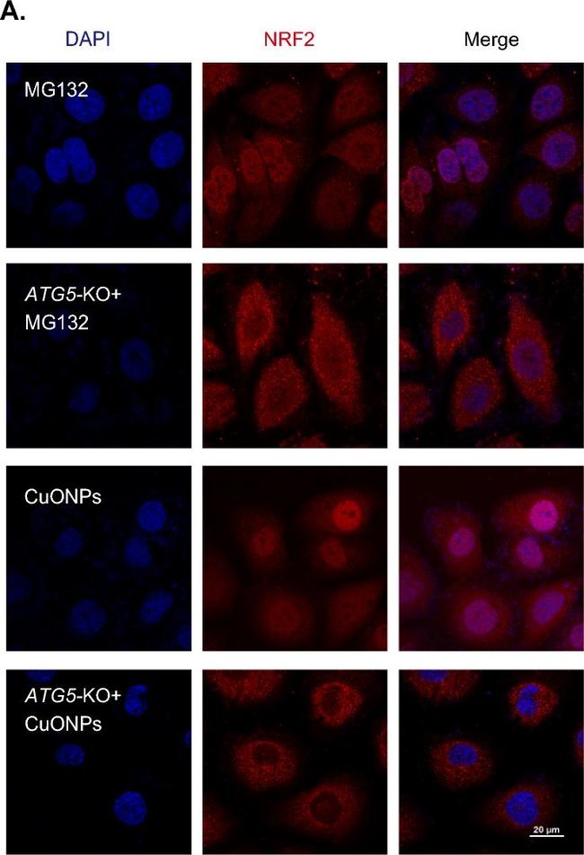 Rabbit IgG (H+L) Highly Cross-Adsorbed Secondary Antibody in Immunocytochemistry (ICC/IF)