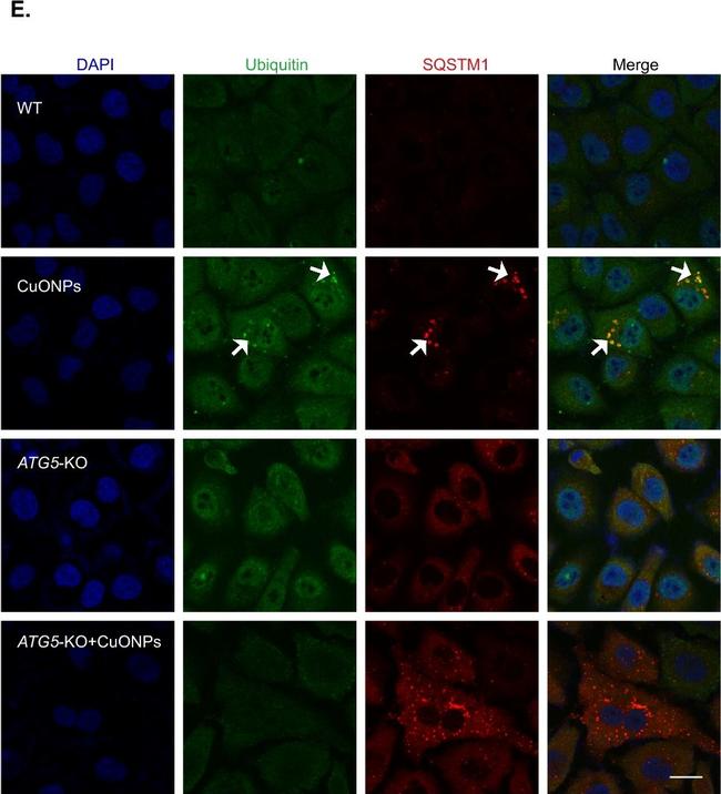 Rabbit IgG (H+L) Highly Cross-Adsorbed Secondary Antibody in Immunocytochemistry (ICC/IF)