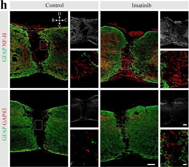 Rabbit IgG (H+L) Highly Cross-Adsorbed Secondary Antibody in Immunohistochemistry (IHC)