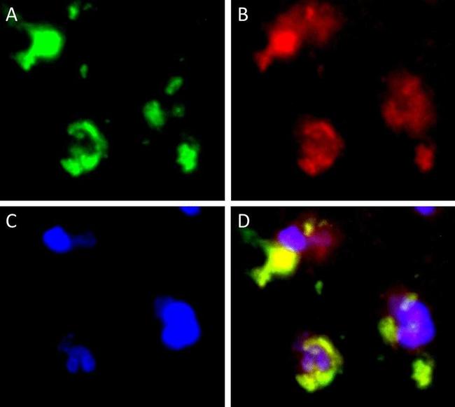 Mouse IgG (H+L) Cross-Adsorbed Secondary Antibody in Immunohistochemistry (IHC)