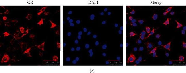 Rabbit IgG (H+L) Secondary Antibody in Immunocytochemistry (ICC/IF)