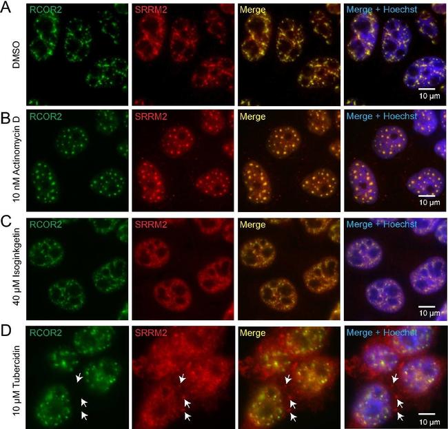 Rabbit IgG (H+L) Secondary Antibody in Immunocytochemistry (ICC/IF)