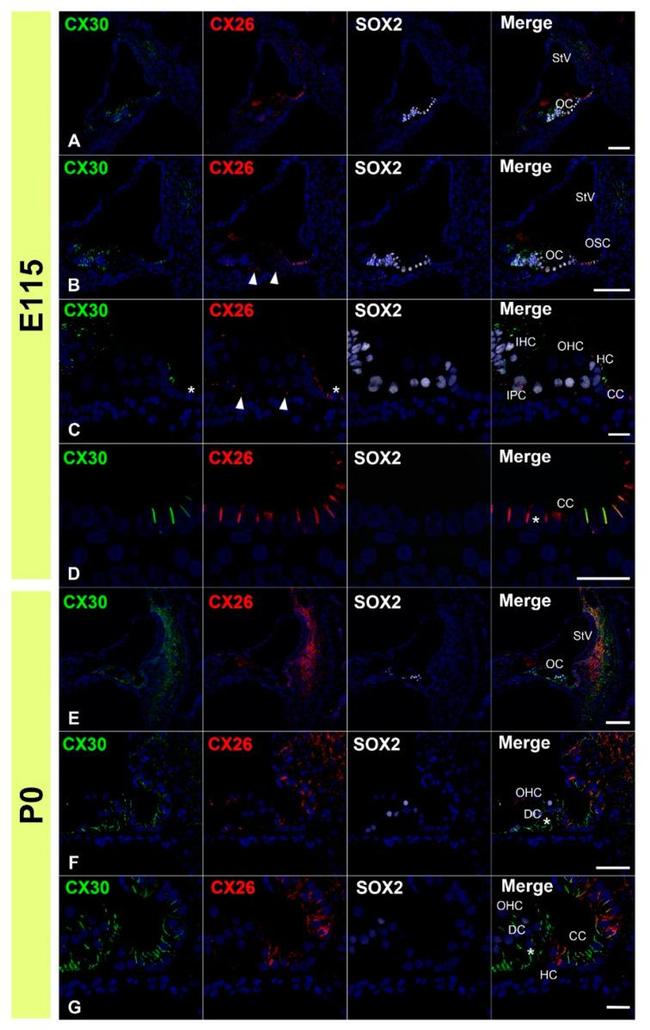 Connexin 26 Antibody in Immunohistochemistry (IHC)