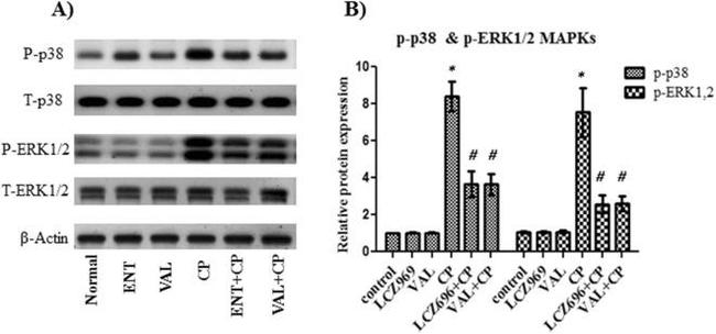 Phospho-p38 MAPK (Thr180, Tyr182) Antibody in Western Blot (WB)