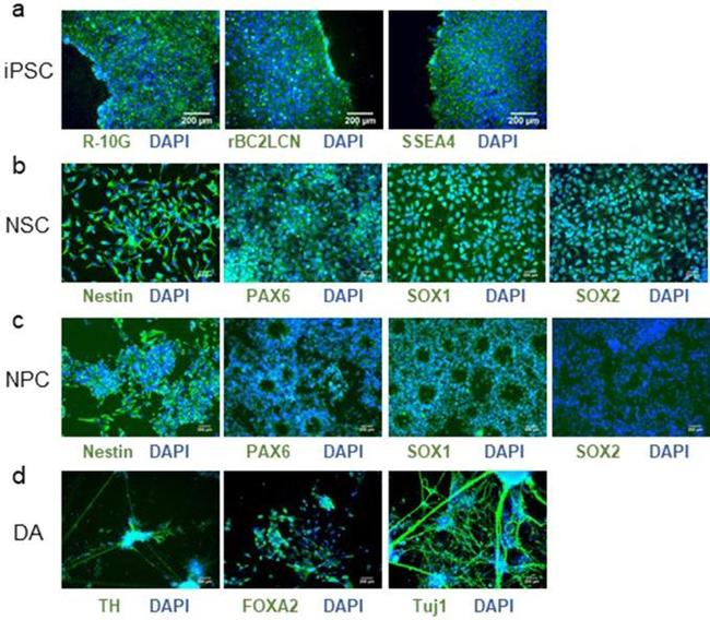 SOX1 Antibody in Immunocytochemistry (ICC/IF)