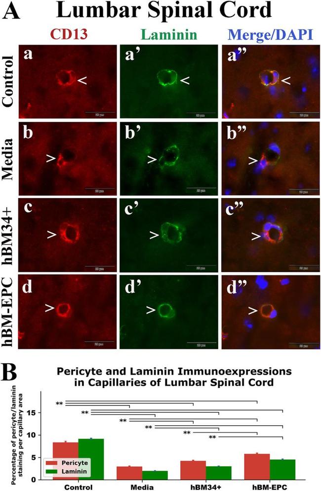 CD13 Antibody in Immunohistochemistry (IHC)