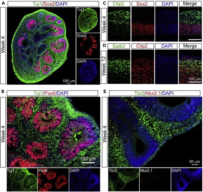 Nkx2.1 Antibody in Immunocytochemistry (ICC/IF)