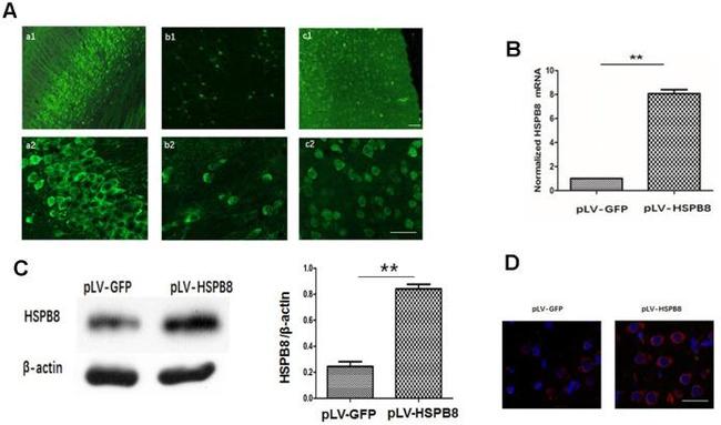 HSPB8 Antibody in Western Blot (WB)