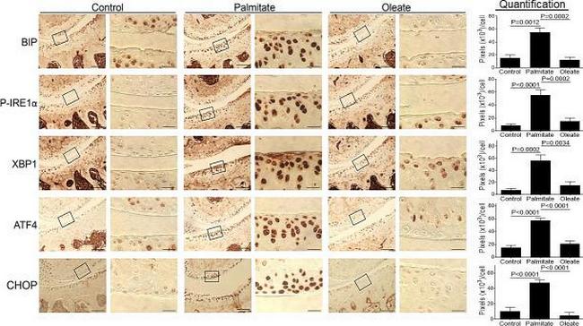 Phospho-IRE1 alpha (Ser724) Antibody in Immunohistochemistry (IHC)