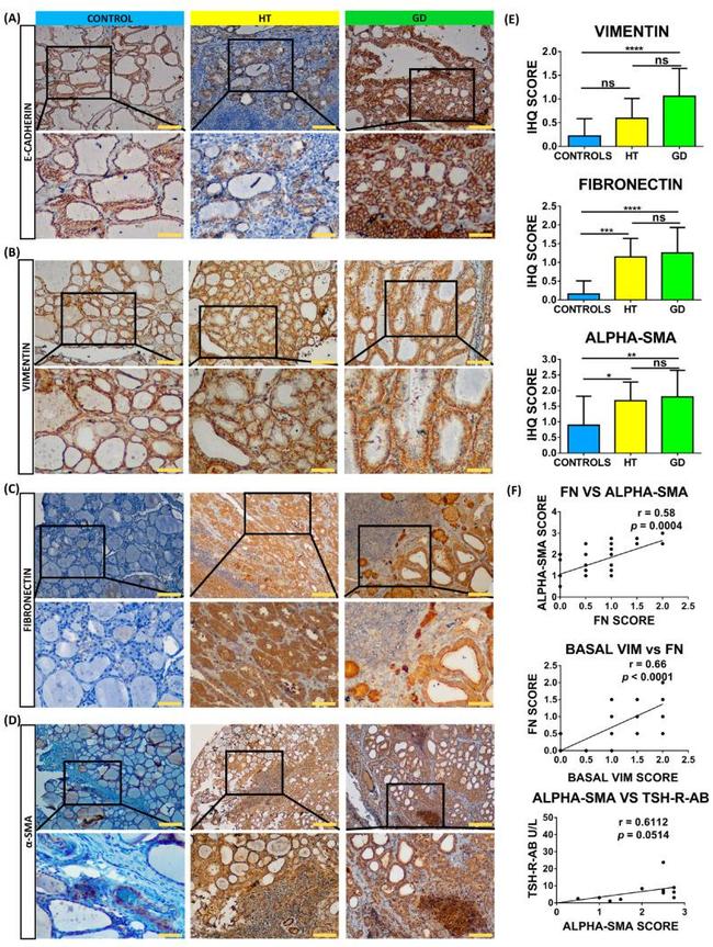 Fibronectin Antibody in Immunohistochemistry (IHC)