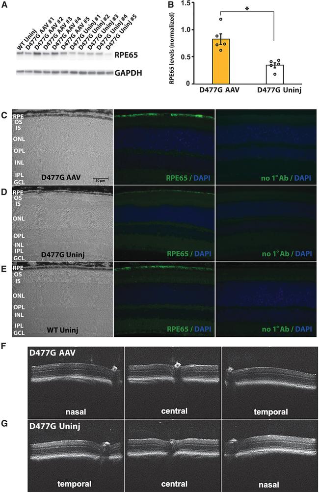 RPE65 Antibody in Western Blot (WB)