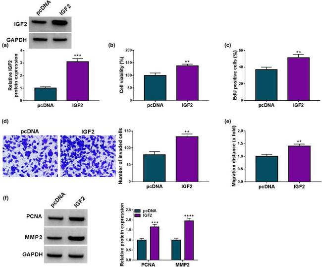 MMP2 Antibody in Western Blot (WB)