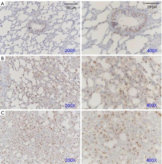 Aquaporin 5 Antibody in Immunohistochemistry (Paraffin) (IHC (P))