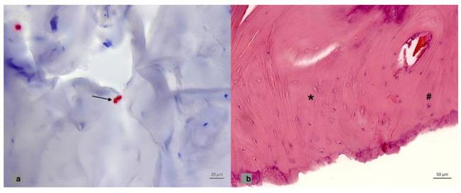 PTH1R Antibody in Immunohistochemistry (Paraffin) (IHC (P))