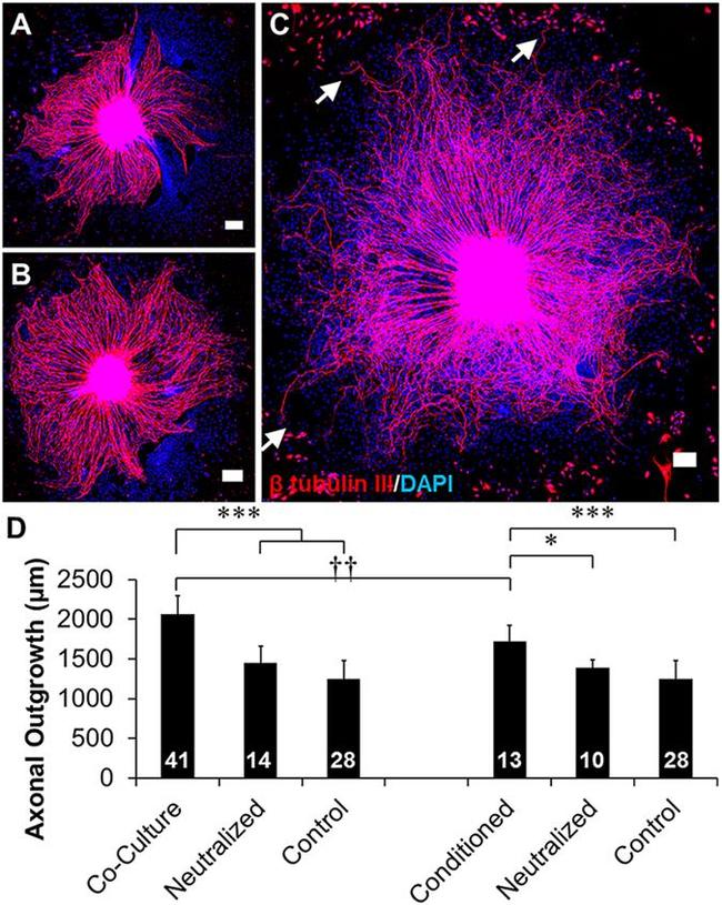 BDNF Antibody in Neutralization (Neu)