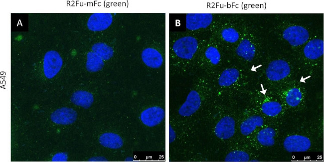 Human IgG (H+L) Cross-Adsorbed Secondary Antibody in Immunocytochemistry (ICC/IF)