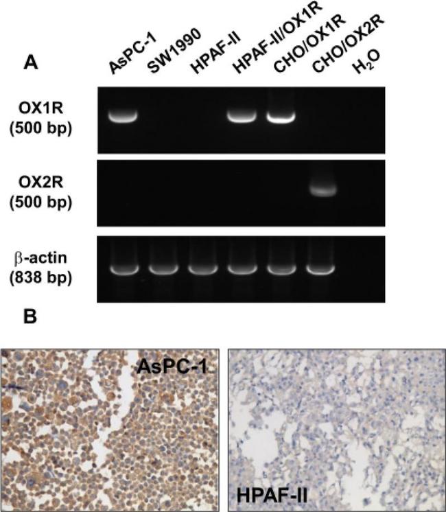 Orexin Receptor 1 Antibody in Immunocytochemistry (ICC/IF)