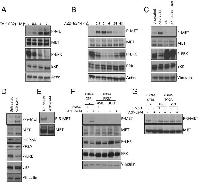 Phospho-c-Met (Ser985) Antibody