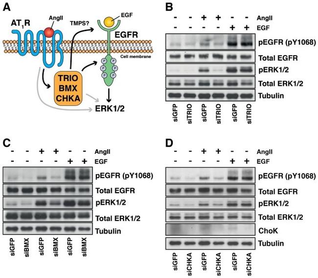 Phospho-EGFR (Tyr1068) Antibody in Western Blot (WB)