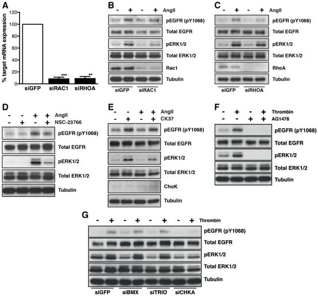 Phospho-EGFR (Tyr1068) Antibody in Western Blot (WB)