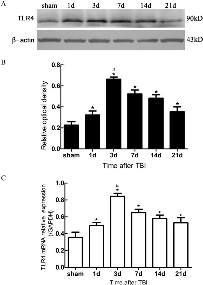 TLR4 Antibody in Western Blot (WB)