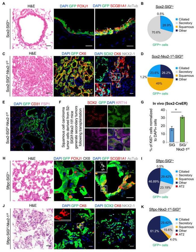 FOXJ1 Antibody in Immunohistochemistry (IHC)