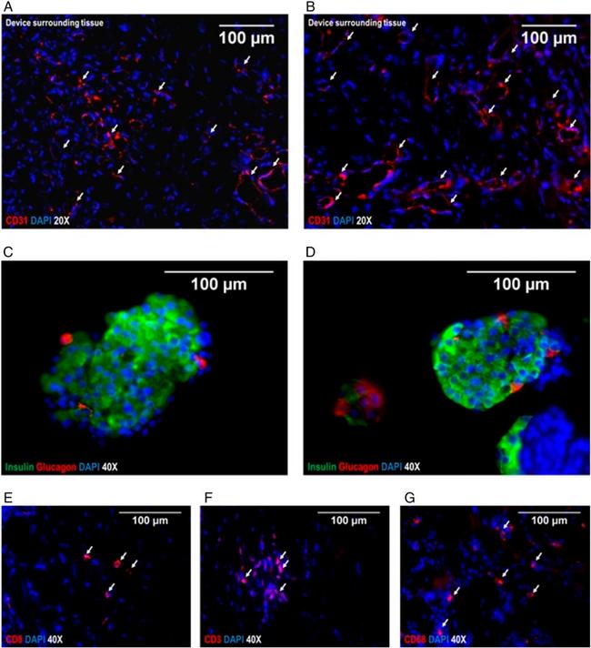 CD68 Antibody in Immunohistochemistry (IHC)