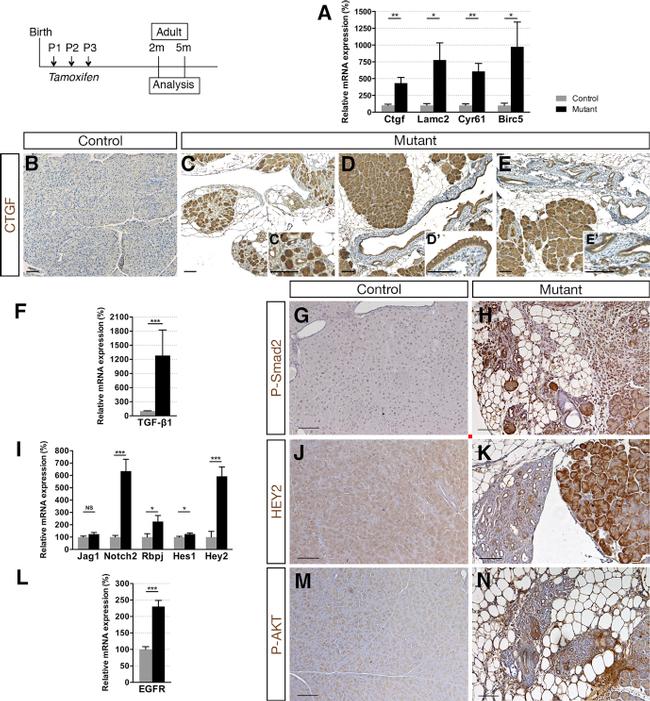 Phospho-SMAD2 (Ser465, Ser467) Antibody in Immunohistochemistry (IHC)