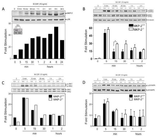 Phospho-p38 MAPK (Thr180, Tyr182) Antibody in Western Blot (WB)