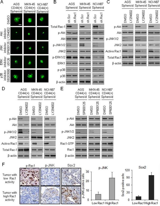 Phospho-RAC1/CDC42 (Ser71) Antibody in Immunohistochemistry (Paraffin) (IHC (P))