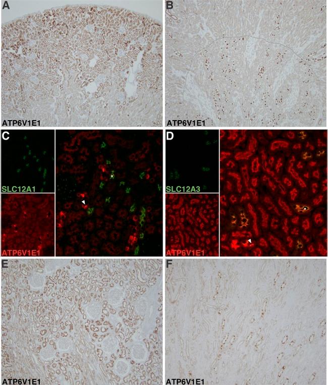 V-ATPase E1 Antibody in Immunocytochemistry, Immunohistochemistry (ICC/IF, IHC)