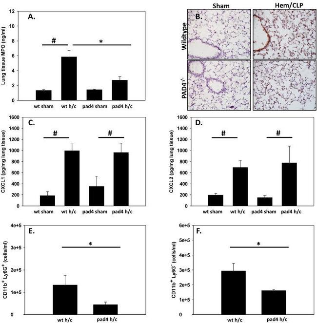 Myeloperoxidase Antibody in Immunohistochemistry (IHC)