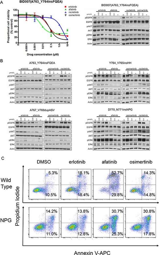 Phospho-EGFR (Tyr1068) Antibody in Western Blot (WB)