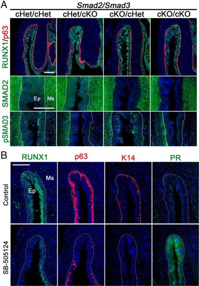 SMAD2 Antibody in Immunohistochemistry (Paraffin) (IHC (P))