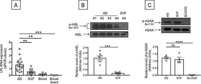 HSL Antibody in Western Blot (WB)