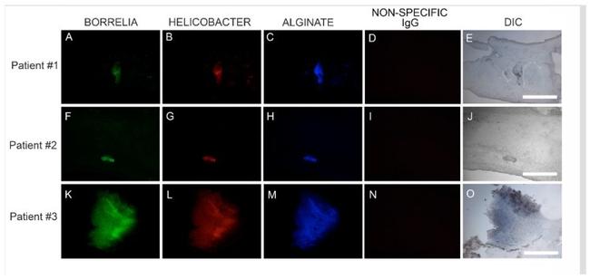 Helicobacter pylori Antibody in Immunocytochemistry, Immunohistochemistry (ICC/IF, IHC)