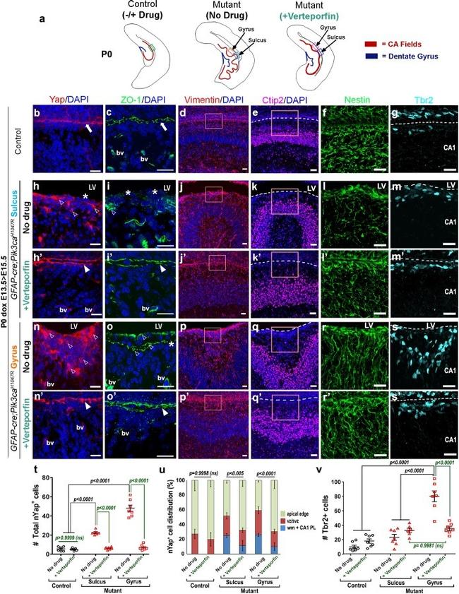 EOMES Antibody in Immunohistochemistry (IHC)