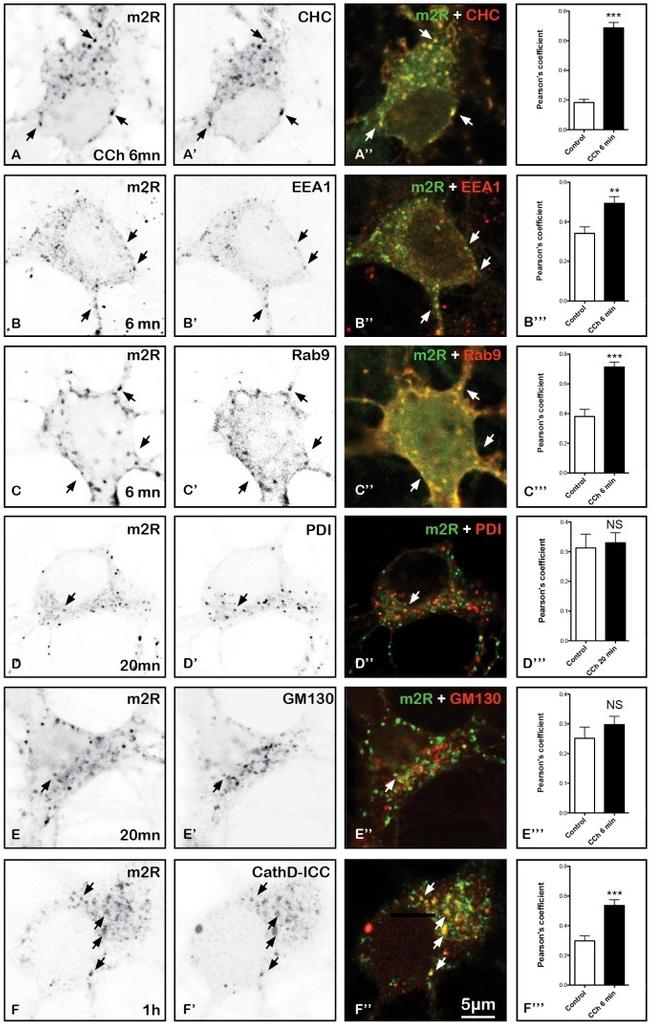 PDI Antibody in Immunohistochemistry (IHC)