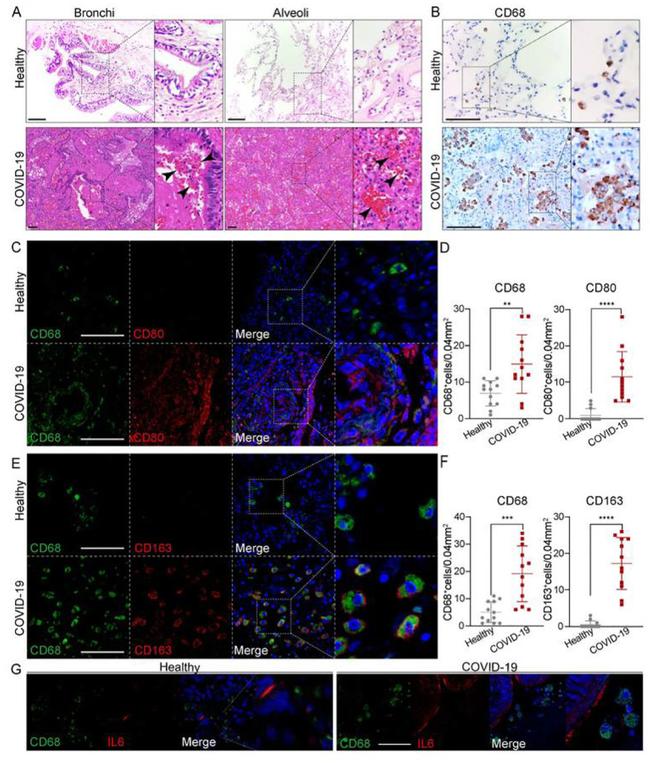 CD68 Antibody in Immunohistochemistry (IHC)