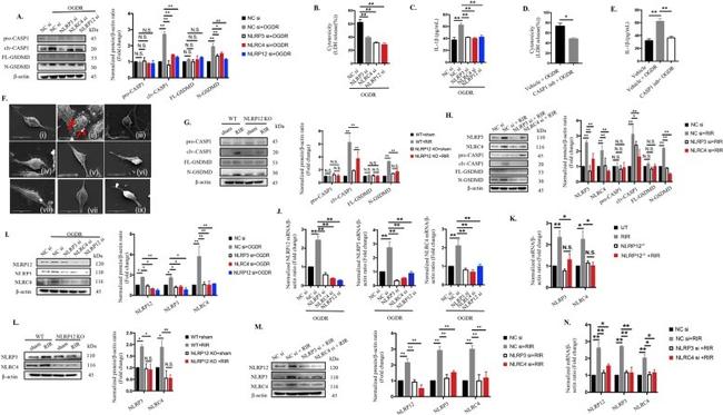 IL-1 beta Antibody in Neutralization (Neu)