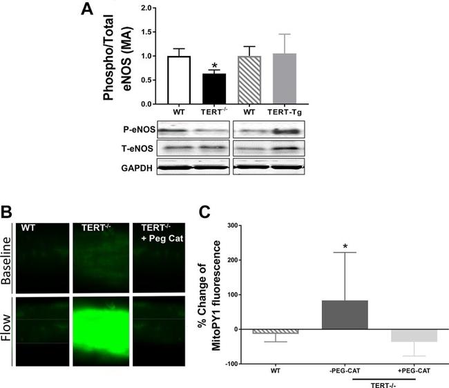 Phospho-eNOS (Ser1177) Antibody in Western Blot (WB)