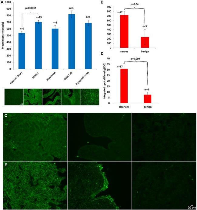 Septin 2 Antibody in Immunocytochemistry (ICC/IF)