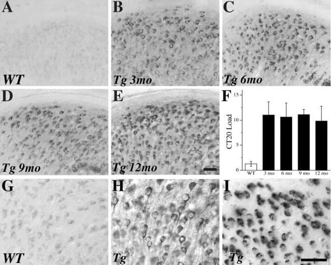 beta Amyloid Antibody in Immunohistochemistry (IHC)