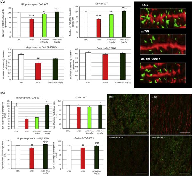 Synaptophysin Antibody in Immunohistochemistry (IHC)